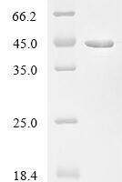 Enterocloster bolteae 90A9 Penicillin-binding protein 2, partial Recombinant Protein - BioCrest Sci