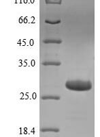 Escherichia coli O157:H7 Large-conductance mechanosensitive channel (mscL) Recombinant Protein - BioCrest Sci