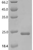 Saccharomyces cerevisiae Autophagy-related protein 8 (ATG8) Recombinant Protein - BioCrest Sci