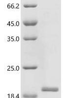 Mouse Sodium/glucose cotransporter 2 (Slc5a2), partial Recombinant Protein - BioCrest Sci