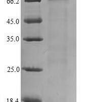 Human mRNA-decapping enzyme 1B (DCP1B) Recombinant Protein - BioCrest Sci