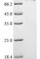 Human Tenascin-X (TNXB) Recombinant Protein - BioCrest Sci