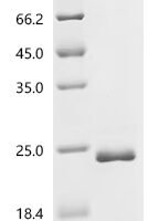 Human Neutral amino acid transporter 9 (SLC38A9),partial Recombinant Protein, C-His, aa 1–119, E.coli - BioCrest Sci