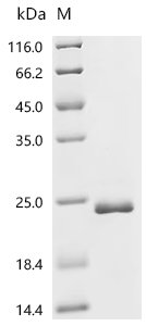 Human Neutral amino acid transporter 9 (SLC38A9),partial Recombinant Protein, C-His, aa 1–119, E.coli, Homo sapiens (Human), E.coli, C-terminal 6xHis-tagged, 20.3 kDa, purity >≥ 95% as determined by SDS-PAGE.