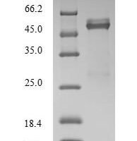 Human Fos-related antigen 2 (FOSL2) Recombinant Protein - BioCrest Sci