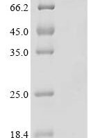 Human Origin recognition complex subunit 1 (ORC1)(R297E,S450Y,T593Y,R846E) Recombinant Protein - BioCrest Sci