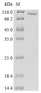 Human Origin recognition complex subunit 1 (ORC1)(R297E,S450Y,T593Y,R846E) Recombinant Protein, Homo sapiens (Human), Homo sapiens (Human), C-terminal 6xHis-tagged, 98.4 kDa, purity >≥ 85% as determined by SDS-PAGE.