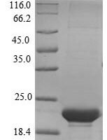 Mouse Epididymal-specific lipocalin-5 (Lcn5) Recombinant Protein - BioCrest Sci