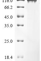 Human Peroxisome proliferator-activated receptor gamma coactivator 1-alpha (PPARGC1A) Recombinant Protein, N-His - BioCrest Sci