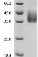 Human Interferon gamma receptor 1 (IFNGR1), partial Recombinant Protein, C-10His - BioCrest Sci