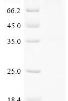 Human Seizure 6-like protein (SEZ6L), partial Recombinant Protein - BioCrest Sci
