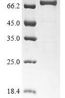 Human High affinity cGMP-specific 3',5'-cyclic phosphodiesterase 9A (PDE9A) Recombinant Protein - BioCrest Sci