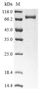 Human High affinity cGMP-specific 3',5'-cyclic phosphodiesterase 9A (PDE9A) Recombinant Protein, Homo sapiens (Human), E.coli, N-terminal 10xHis-tagged and C-terminal Myc-tagged, 76.0 kDa, purity >≥ 85% as determined by SDS-PAGE.