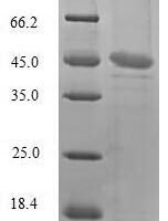 Sheep Tumor necrosis factor (TNF), partial Recombinant Protein, N-GST - BioCrest Sci