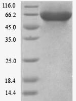 Human Kinesin light chain 3 (KLC3) Recombinant Protein, N-His - BioCrest Sci