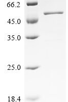 Macaca fascicularis Paraneoplastic antigen Ma2 homolog (PNMA2) Recombinant Protein, C-His - BioCrest Sci