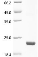 Escherichia coli O157:H7 Uncharacterized protein yqgB (yqgB) Recombinant Protein, N-His-KSI - BioCrest Sci