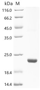 Escherichia coli O157:H7 Uncharacterized protein yqgB (yqgB) Recombinant Protein, N-His-KSI, Escherichia coli O157:H7, E.coli, N-terminal 6xHis-KSI-tagged, 20.2 kDa, purity >≥ 90% as determined by SDS-PAGE.