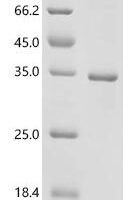 Anopheles gambiae AGAP011647-PA (Obp1), partial Recombinant Protein - BioCrest Sci