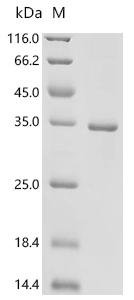 Anopheles gambiae AGAP011647-PA (Obp1), partial Recombinant Protein, Anopheles gambiae (African malaria mosquito), E.coli, C-terminal 6xHis-tagged, 35.8 kDa, purity >≥ 95% as determined by SDS-PAGE.