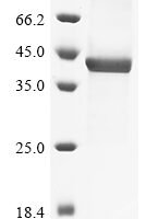 Human Prostatic acid phosphatase (ACP3), partial Recombinant Protein, C-10His, aa 33–382, Baculovirus - BioCrest Sci