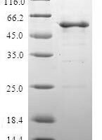 Human Clathrin light chain A (CLTA) Recombinant Protein, N-GST - BioCrest Sci