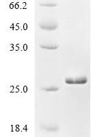 Rat Sodium channel protein type 11 subunit alpha (Scn11a), partial Recombinant Protein - BioCrest Sci