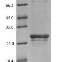 Human N (4)- (beta-N-acetylglucosaminyl)-L-asparaginase (AGA), partial Recombinant Protein, N-His-SUMO, aa 206–346 - BioCrest Sci