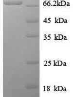 Human Proto-oncogene c-Rel (REL), partial Recombinant Protein, N-His, aa 3–616, E.coli - BioCrest Sci