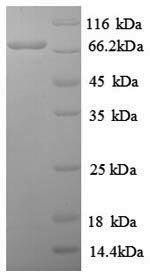 Human Proto-oncogene c-Rel (REL), partial Recombinant Protein, N-His, aa 3–616, E.coli, Homo sapiens (Human), E.coli, N-terminal 6xHis-tagged, 71.9 kDa, purity >≥ 90% as determined by SDS-PAGE.