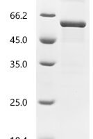 Newcastle disease virus Hemagglutinin-neuraminidase (HN), partial Recombinant Protein, N-His-ZZ - BioCrest Sci