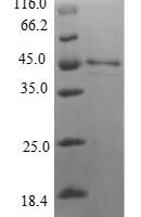 Human Interleukin-36 gamma (IL36G) Recombinant Protein - BioCrest Sci