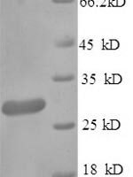 Klebsiella pneumoniae Metallo-beta-lactamase type 2 (blaNDM-1) Recombinant Protein, N-His-SUMO - BioCrest Sci