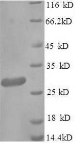 Klebsiella pneumoniae Metallo-beta-lactamase type 2 (blaNDM-1) Recombinant Protein, N-His-SUMO, Klebsiella pneumoniae, E.coli, N-terminal 6xHis-SUMO-tagged, 38.6 kDa, purity >≥ 90% as determined by SDS-PAGE.