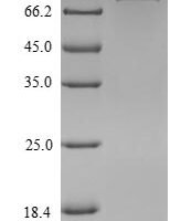 Mouse Isthmin-1 (Ism1) Recombinant Protein, N-His - BioCrest Sci
