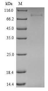 Mouse Isthmin-1 (Ism1) Recombinant Protein, N-His, Mus musculus (Mouse), Yeast, N-terminal 6xHis-tagged, 50.1 kDa, purity >≥ 90% as determined by SDS-PAGE.
