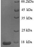Human Phospholipase A2, membrane associated (PLA2G2A) Recombinant Protein - BioCrest Sci