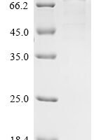 Human Sucrase-isomaltase, intestinal (SI), partial Recombinant Protein - BioCrest Sci