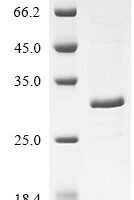 Escherichia coli Probable phospholipid-binding lipoprotein mlaA (mlaA) Recombinant Protein - BioCrest Sci