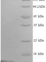 Mouse C-C motif chemokine 9 (Ccl9), partial Recombinant Protein - BioCrest Sci