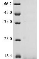 Viscum album Chitin-binding lectin Recombinant Protein - BioCrest Sci