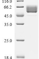 Human Alpha-1-antichymotrypsin (SERPINA3) Recombinant Protein, C-10His - BioCrest Sci