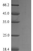 Aspergillus kawachii Probable endo-beta-1,4-glucanase D (eglD) Recombinant Protein, N-His-SUMOstar - BioCrest Sci