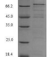 Hepatitis E virus genotype 1 Secreted protein ORF2 (ORF2), partial Recombinant Protein, N-10His - BioCrest Sci