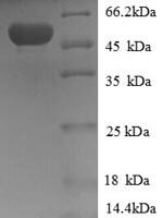 Human Hydroxyacylglutathione hydrolase, mitochondrial (HAGH), partial Recombinant Protein - BioCrest Sci
