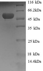 Human Hydroxyacylglutathione hydrolase, mitochondrial (HAGH), partial Recombinant Protein, Homo sapiens (Human), E.coli, N-terminal GST-tagged, 55.7 kDa, purity >≥ 90% as determined by SDS-PAGE.