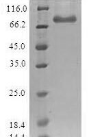 Human Histone-lysine N-methyltransferase SETDB1 (SETDB1) Recombinant Protein - BioCrest Sci
