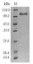 Human Histone-lysine N-methyltransferase SETDB1 (SETDB1) Recombinant Protein, Homo sapiens (Human), E.coli, N-terminal GST-tagged, 71.7 kDa, purity >≥ 90% as determined by SDS-PAGE.