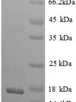 Rat Beta-nerve growth factor (Ngf), partial Recombinant Protein - BioCrest Sci