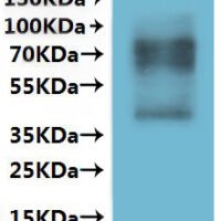 Human Somatostatin receptor type 1 (SSTR1)-VLPs Recombinant Protein - BioCrest Sci